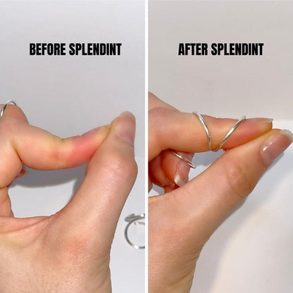SPLENDINT - Hand-therapist mechanics. Fine jewelry finish