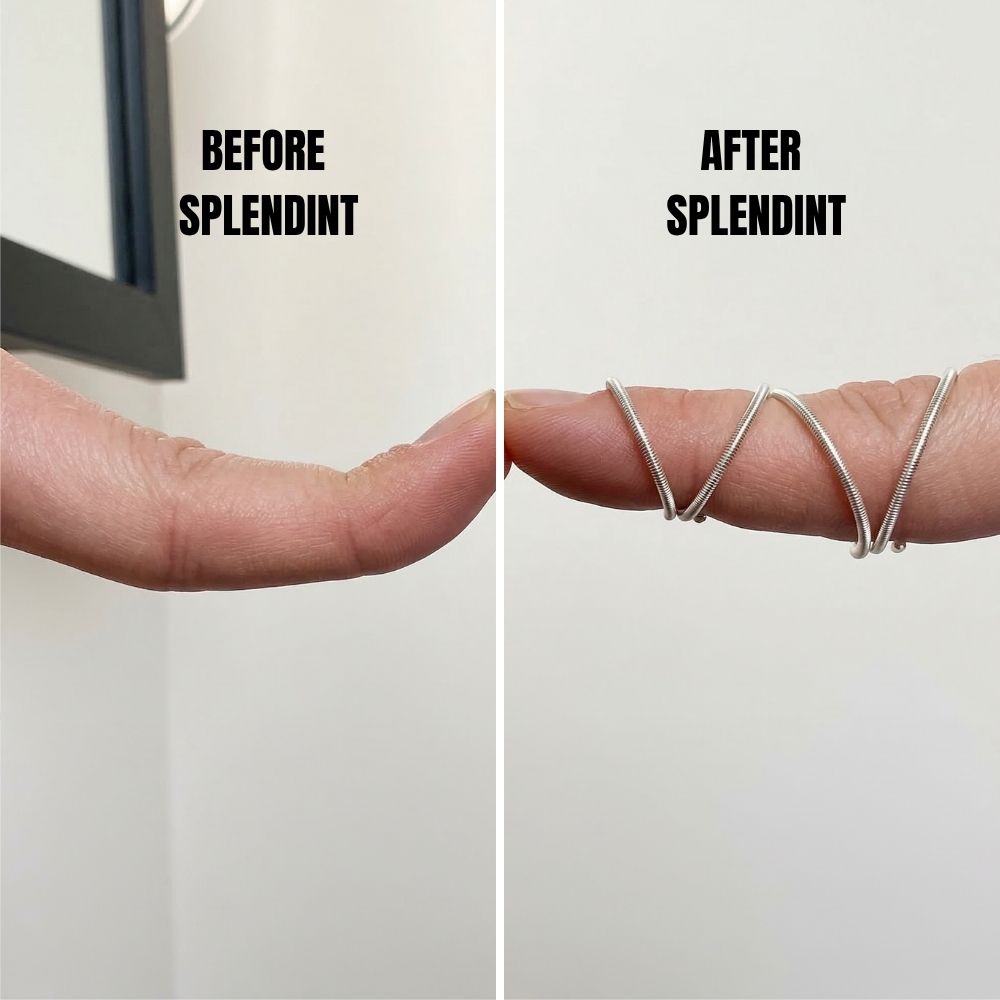 SPLENDINT - Hand-therapist mechanics. Fine jewelry finish