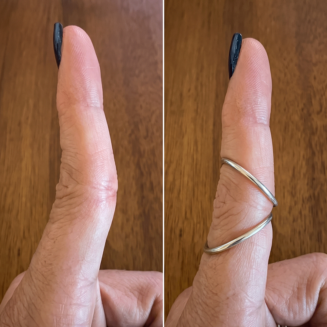 SPLENDINT - Works like a splint, looks like a ring