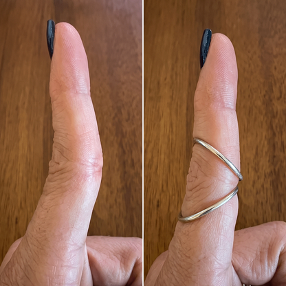 SPLENDINT - Works like a splint, looks like a ring