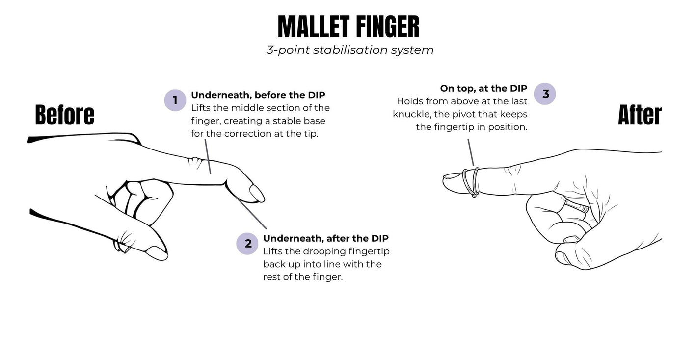 splendint fit fingertip