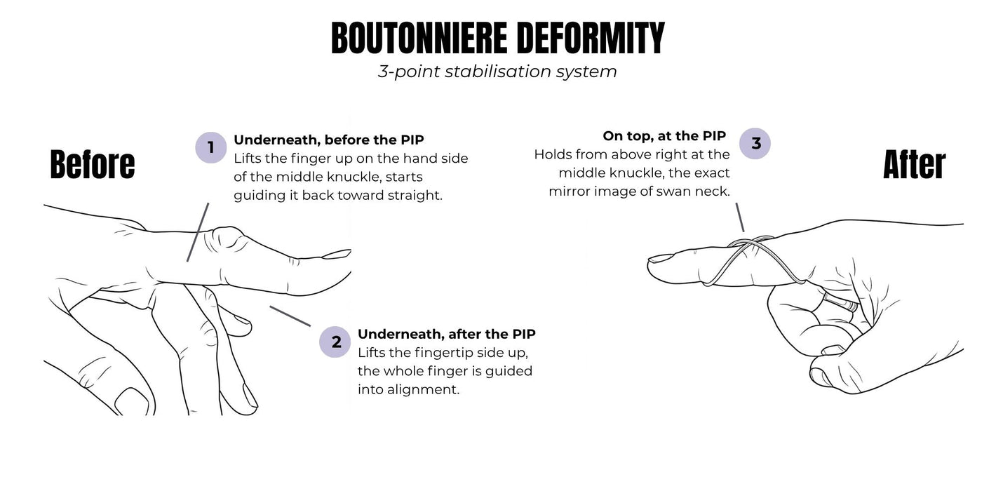 splendint fit middle joint